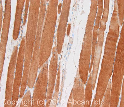 Immunohistochemistry (Formalin/PFA-fixed paraffin-embedded sections) - Anti-pan PDK antibody [3H5BE12] (AB115321), expandable thumbnail