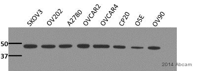 Western blot - Anti-pan PDK antibody [3H5BE12] (AB115321), expandable thumbnail
