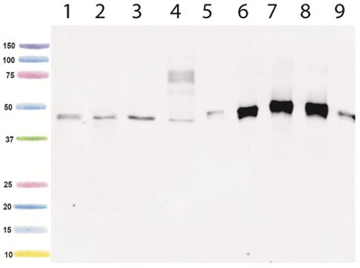 Western blot - Anti-pan PDK antibody [3H5BE12] (AB115321), expandable thumbnail