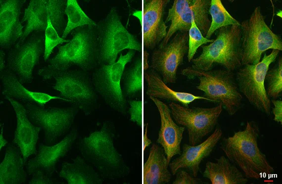 Immunocytochemistry/ Immunofluorescence - Anti-pan PKC (phospho T410) antibody [HL1279] - BSA and Azide free (AB313842)