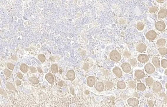 Immunohistochemistry (Formalin/PFA-fixed paraffin-embedded sections) - Anti-pan PKC (phospho T410) antibody [HL1279] - BSA and Azide free (AB313842)