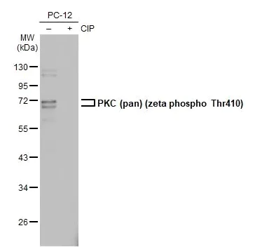 Western blot - Anti-pan PKC (phospho T410) antibody [HL1279] - BSA and Azide free (AB313842)