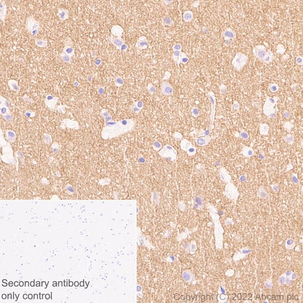 Immunohistochemistry (Formalin/PFA-fixed paraffin-embedded sections) - Anti-pan SCN antibody [EPR25134-4] (AB300112)