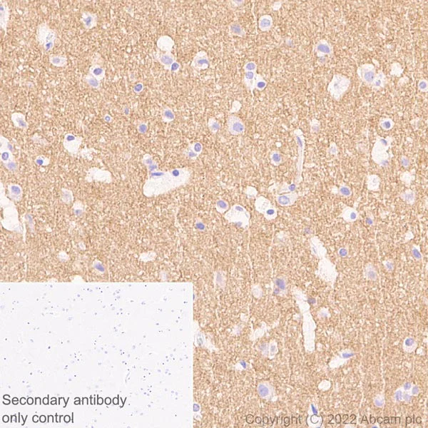 Immunohistochemistry (Formalin/PFA-fixed paraffin-embedded sections) - Anti-pan SCN antibody [EPR25134-4] (AB300112)