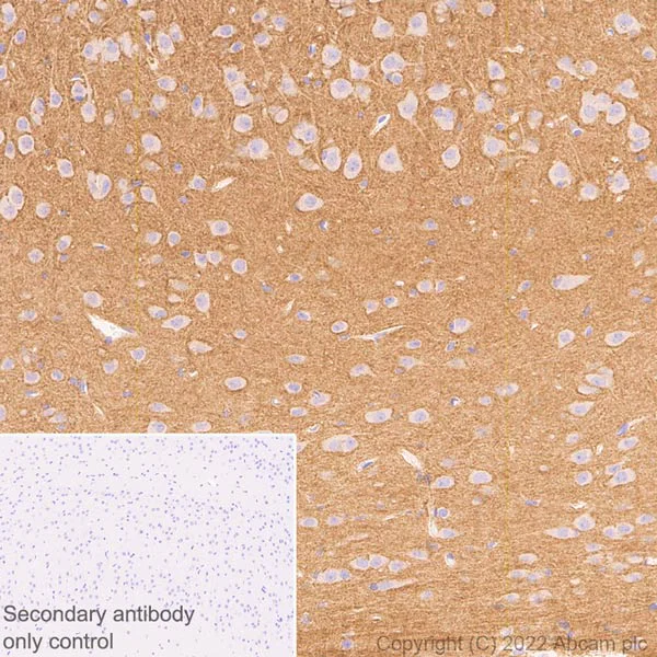Immunohistochemistry (Formalin/PFA-fixed paraffin-embedded sections) - Anti-pan SCN antibody [EPR25134-4] (AB300112)