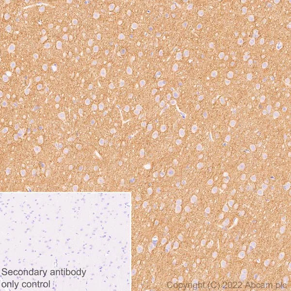 Immunohistochemistry (Formalin/PFA-fixed paraffin-embedded sections) - Anti-pan SCN antibody [EPR25134-4] (AB300112)