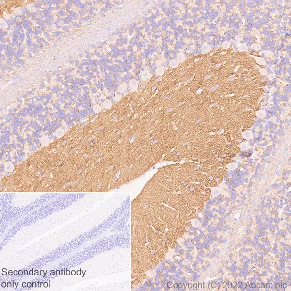 Immunohistochemistry (Formalin/PFA-fixed paraffin-embedded sections) - Anti-pan SCN antibody [EPR25134-4] (BSA and Azide free) (AB300113)