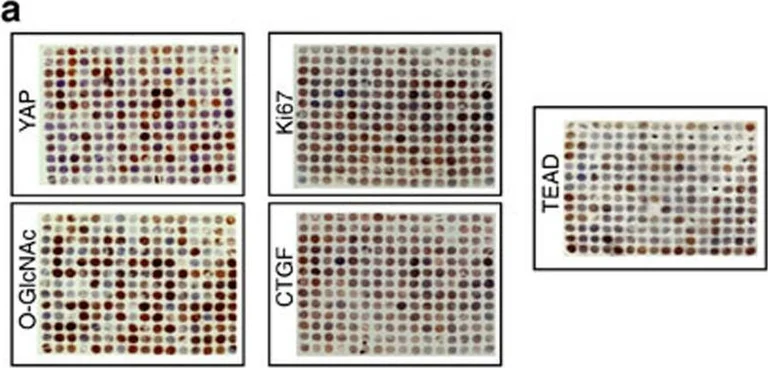 Immunohistochemistry - Anti-PAN TEAD antibody (AB97460)