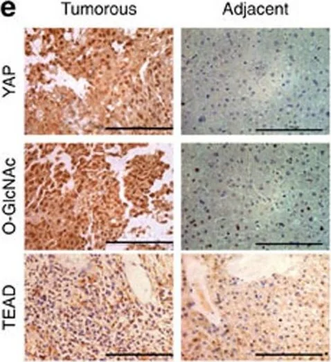 Immunohistochemistry - Anti-PAN TEAD antibody (AB97460)
