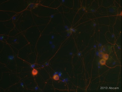 Immunocytochemistry/ Immunofluorescence - Anti-Pan Trk antibody [EP1058Y] (ab76291), expandable thumbnail