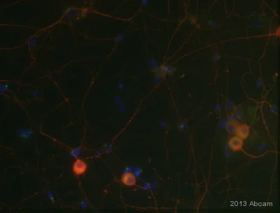 Immunocytochemistry/ Immunofluorescence - Anti-Pan Trk antibody [EP1058Y] (AB76291)