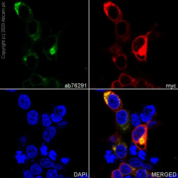Immunocytochemistry/ Immunofluorescence - Anti-Pan Trk antibody [EP1058Y] (AB76291)