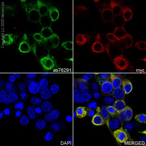 Immunocytochemistry/ Immunofluorescence - Anti-Pan Trk antibody [EP1058Y] (AB76291)