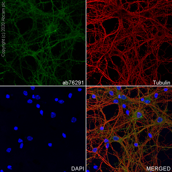 Anti-Pan Trk antibody [EP1058Y] Rabbit monoclonal (ab76291