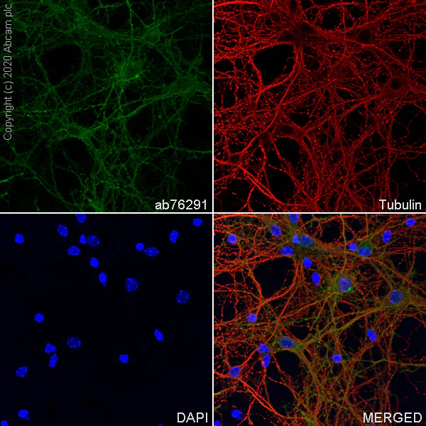 Immunocytochemistry/ Immunofluorescence - Anti-Pan Trk antibody [EP1058Y] (AB76291)