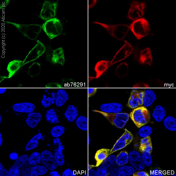 Immunocytochemistry/ Immunofluorescence - Anti-Pan Trk antibody [EP1058Y] (ab76291), expandable thumbnail