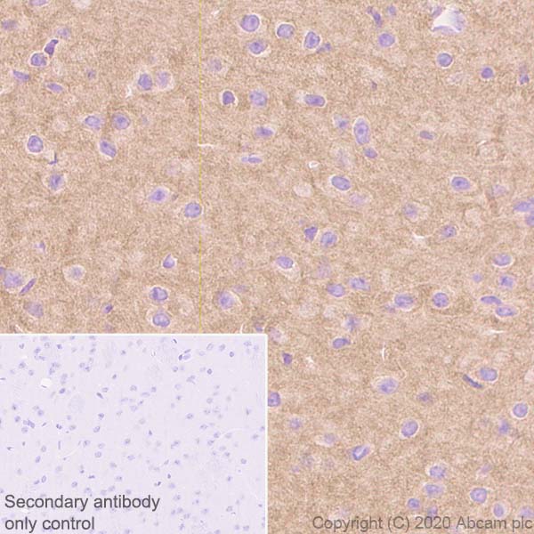 Immunohistochemistry (Formalin/PFA-fixed paraffin-embedded sections) - Anti-Pan Trk antibody [EP1058Y] (ab76291), expandable thumbnail