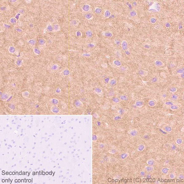 Immunohistochemistry (Formalin/PFA-fixed paraffin-embedded sections) - Anti-Pan Trk antibody [EP1058Y] (AB76291)