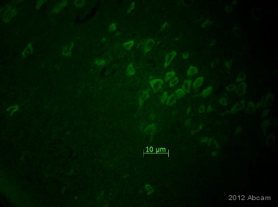 Immunohistochemistry (Formalin/PFA-fixed paraffin-embedded sections) - Anti-Pan Trk antibody [EP1058Y] (ab76291), expandable thumbnail