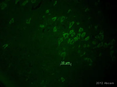 Immunohistochemistry (Formalin/PFA-fixed paraffin-embedded sections) - Anti-Pan Trk antibody [EP1058Y] (AB76291)