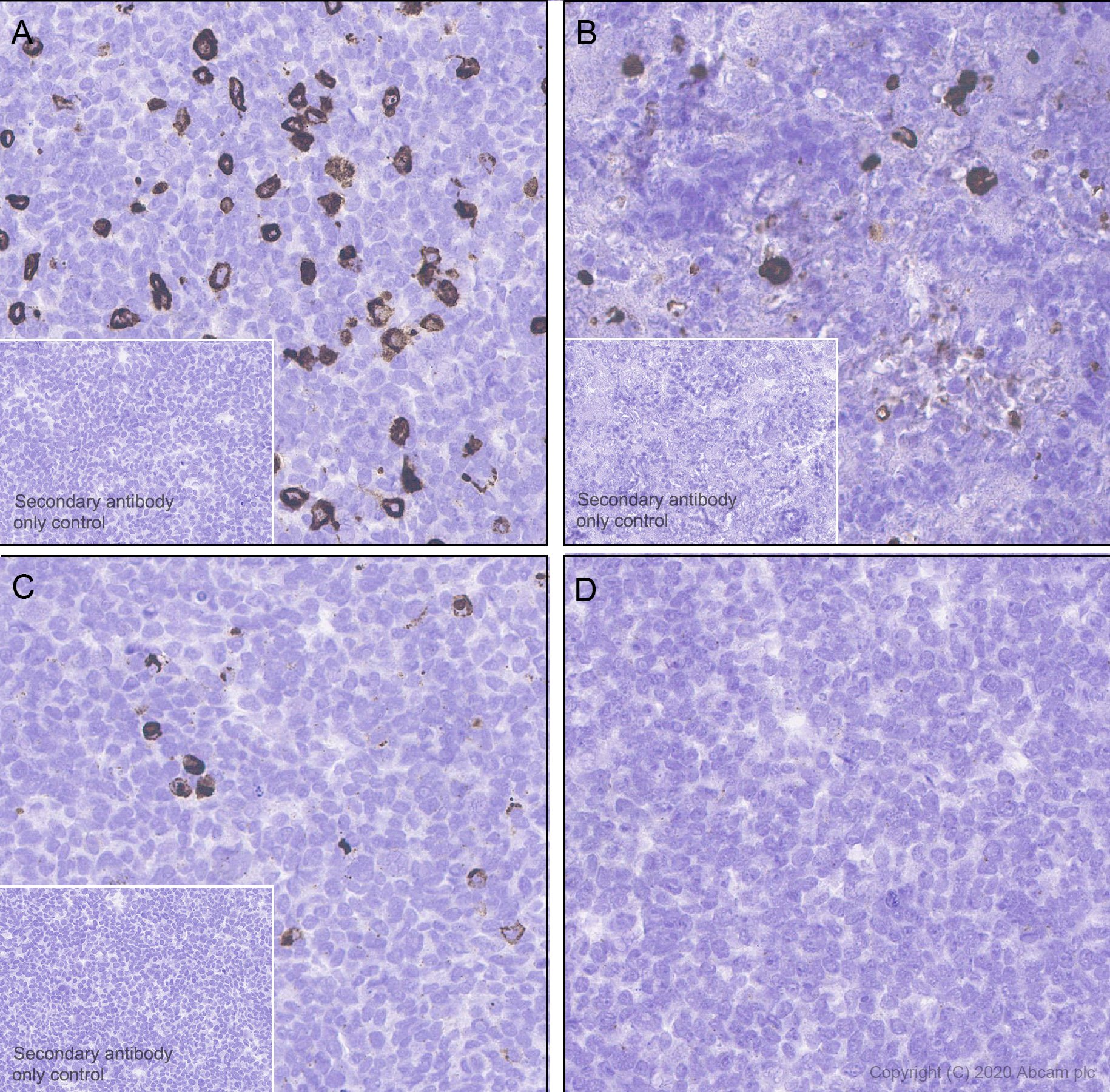 Immunohistochemistry (Formalin/PFA-fixed paraffin-embedded sections) - Anti-Pan Trk antibody [EP1058Y] (AB76291), expandable thumbnail