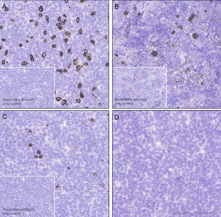 Immunohistochemistry (Formalin/PFA-fixed paraffin-embedded sections) - Anti-Pan Trk antibody [EP1058Y] (AB76291)
