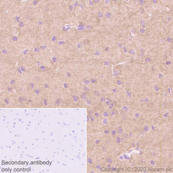 Immunohistochemistry (Formalin/PFA-fixed paraffin-embedded sections) - Anti-Pan Trk antibody [EP1058Y] (ab76291), expandable thumbnail