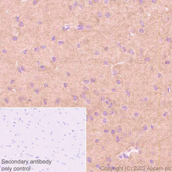 Immunohistochemistry (Formalin/PFA-fixed paraffin-embedded sections) - Anti-Pan Trk antibody [EP1058Y] (AB76291)