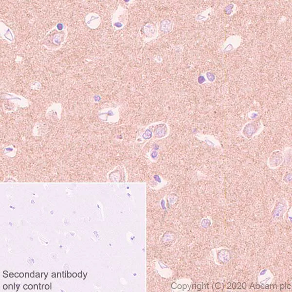 Immunohistochemistry (Formalin/PFA-fixed paraffin-embedded sections) - Anti-Pan Trk antibody [EP1058Y] (AB76291)