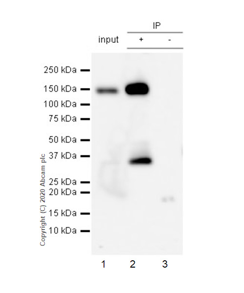 Immunoprecipitation - Anti-Pan Trk antibody [EP1058Y] (AB76291), expandable thumbnail