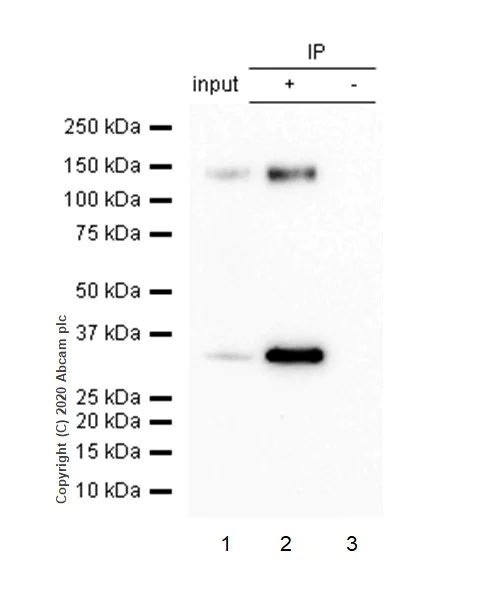 Immunoprecipitation - Anti-Pan Trk antibody [EP1058Y] (AB76291)