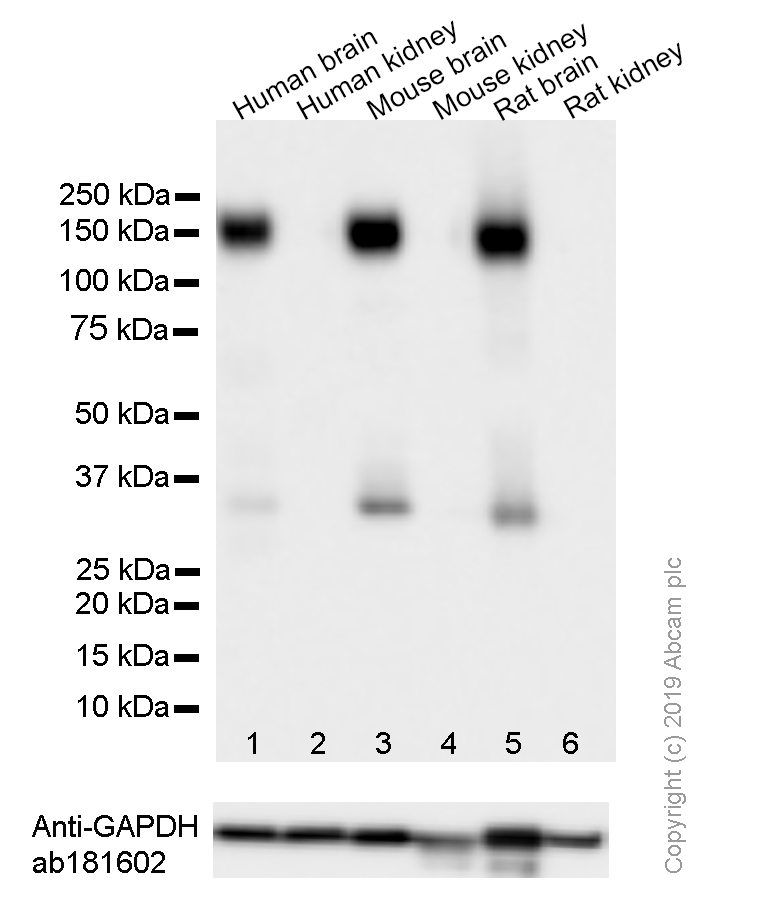 Western blot - Anti-Pan Trk antibody [EP1058Y] (ab76291), expandable thumbnail