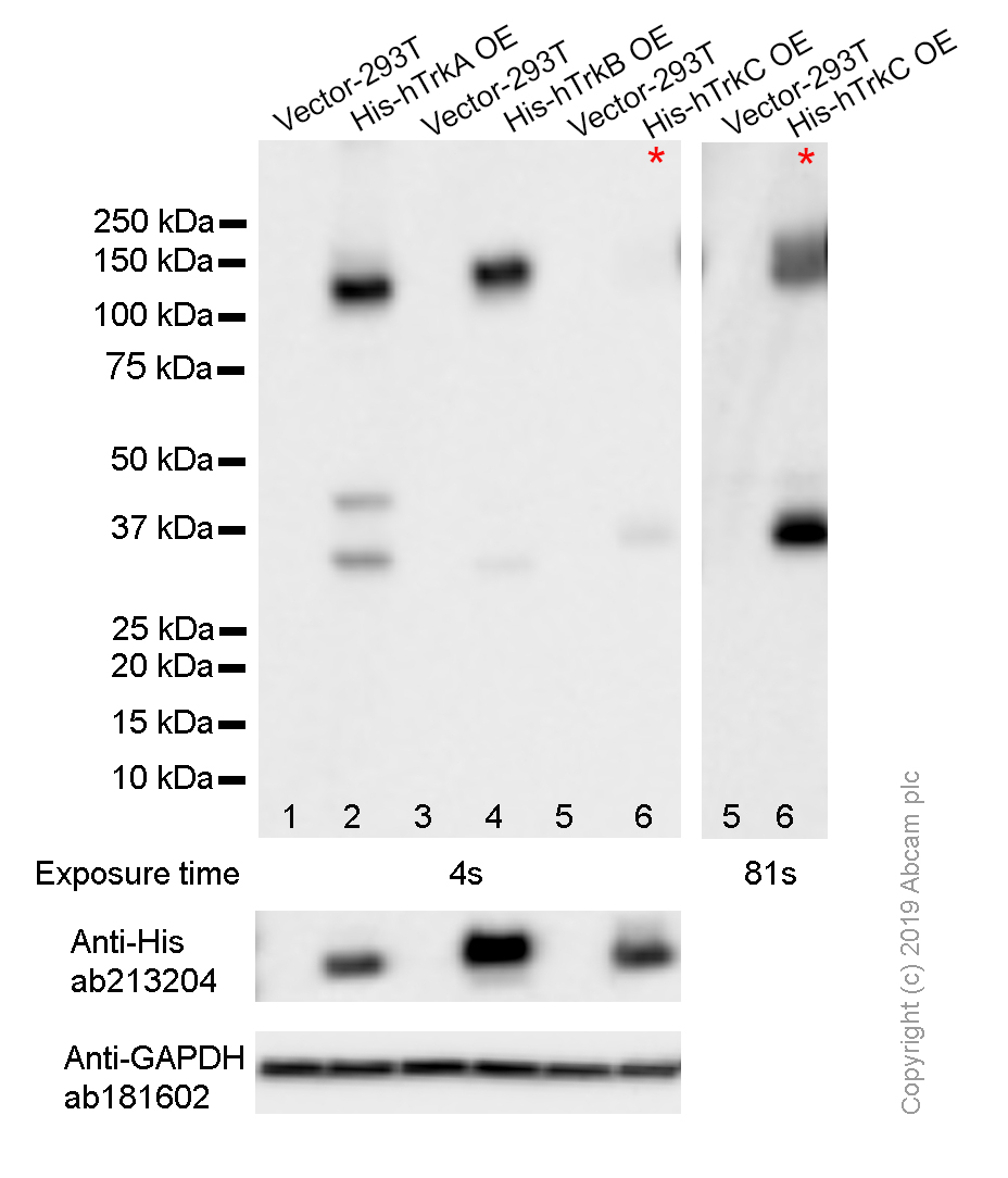 Western blot - Anti-Pan Trk antibody [EP1058Y] (AB76291), expandable thumbnail