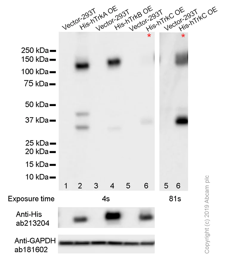 Western blot - Anti-Pan Trk antibody [EP1058Y] (AB76291)