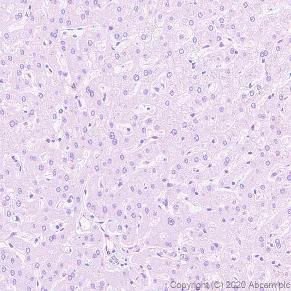 Immunohistochemistry (Formalin/PFA-fixed paraffin-embedded sections) - Anti-Pan Trk antibody [EP1058Y] - BSA and Azide free (AB188825)