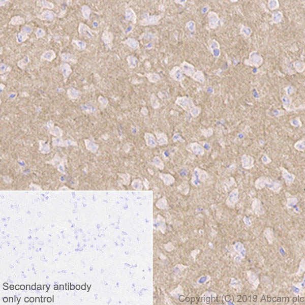 Immunohistochemistry (Formalin/PFA-fixed paraffin-embedded sections) - Anti-Pan Trk antibody [EPR17341-4] (AB246551), expandable thumbnail