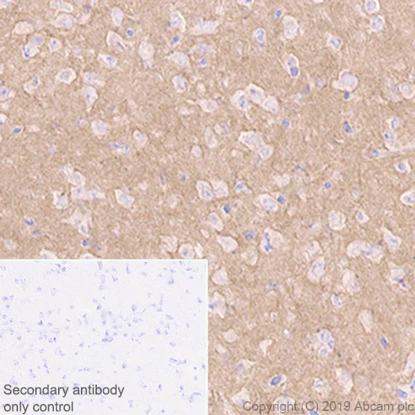 Immunohistochemistry (Formalin/PFA-fixed paraffin-embedded sections) - Anti-Pan Trk antibody [EPR17341-4] (AB246551)