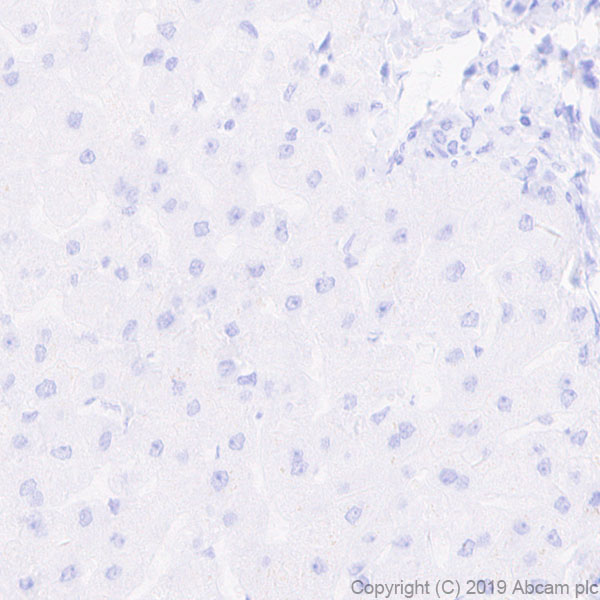 Immunohistochemistry (Formalin/PFA-fixed paraffin-embedded sections) - Anti-Pan Trk antibody [EPR17341-4] (ab246551), expandable thumbnail