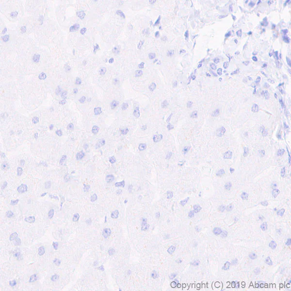 Immunohistochemistry (Formalin/PFA-fixed paraffin-embedded sections) - Anti-Pan Trk antibody [EPR17341-4] (AB246551)