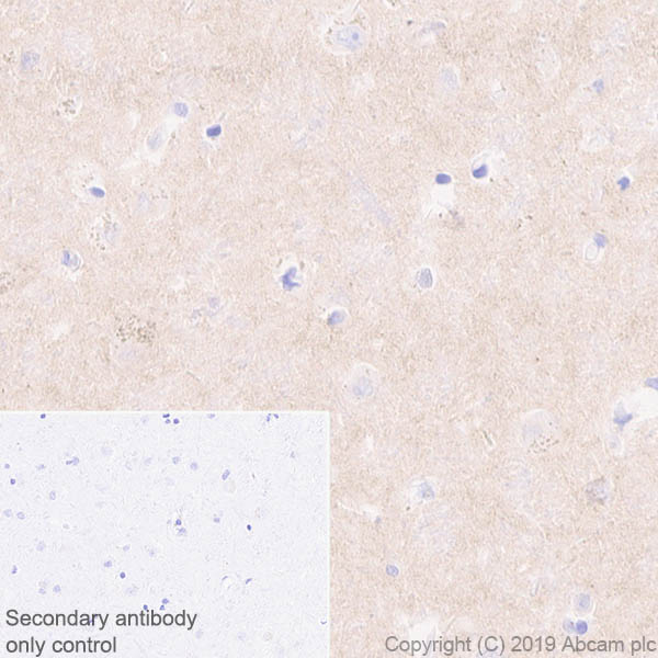 Immunohistochemistry (Formalin/PFA-fixed paraffin-embedded sections) - Anti-Pan Trk antibody [EPR17341-4] (AB246551), expandable thumbnail