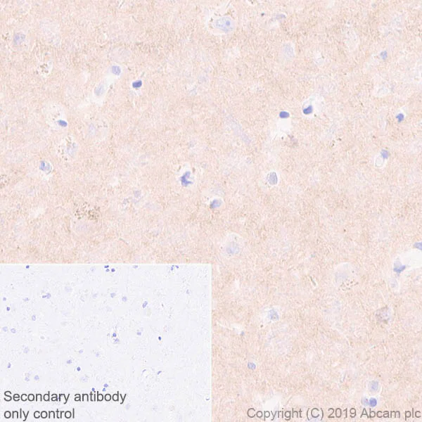 Immunohistochemistry (Formalin/PFA-fixed paraffin-embedded sections) - Anti-Pan Trk antibody [EPR17341-4] (AB246551)
