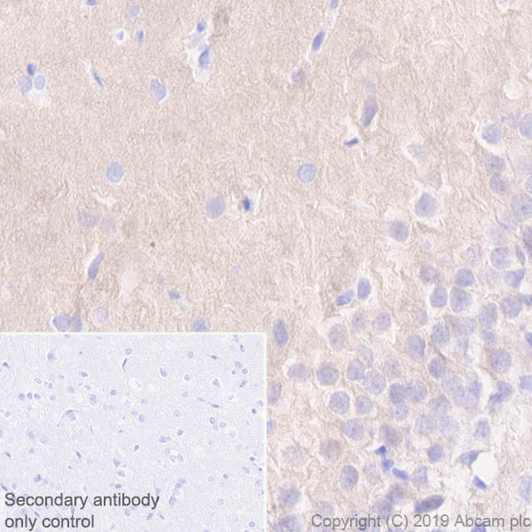 Immunohistochemistry (Formalin/PFA-fixed paraffin-embedded sections) - Anti-Pan Trk antibody [EPR17341-4] (AB246551), expandable thumbnail