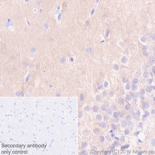 Immunohistochemistry (Formalin/PFA-fixed paraffin-embedded sections) - Anti-Pan Trk antibody [EPR17341-4] (AB246551)