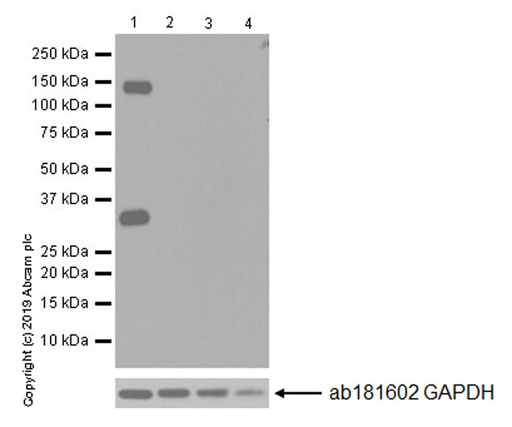 Western blot - Anti-Pan Trk antibody [EPR17341-4] (ab246551), expandable thumbnail