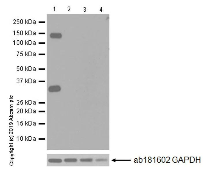 Western blot - Anti-Pan Trk antibody [EPR17341-4] (AB246551)