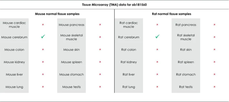 Immunohistochemistry (Formalin/PFA-fixed paraffin-embedded sections) - Anti-Pan Trk antibody [EPR17341] (AB181560)