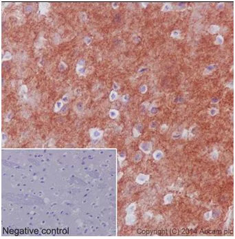 Immunohistochemistry (Formalin/PFA-fixed paraffin-embedded sections) - Anti-Pan Trk antibody [EPR17341] - BSA and Azide free (AB218577)
