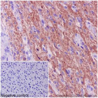 Immunohistochemistry (Formalin/PFA-fixed paraffin-embedded sections) - Anti-Pan Trk antibody [EPR17341] - BSA and Azide free (AB218577)