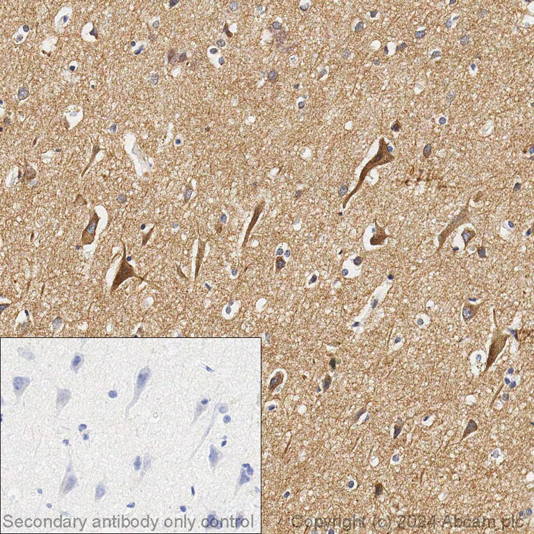 Immunohistochemistry (Formalin/PFA-fixed paraffin-embedded sections) - Anti-Pan Trk antibody [EPR17341] - BSA and Azide free (AB218577)