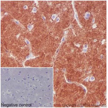 Immunohistochemistry (Formalin/PFA-fixed paraffin-embedded sections) - Anti-Pan Trk antibody [EPR17341] - BSA and Azide free (AB218577)
